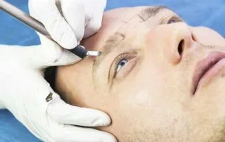man having microblading treatment